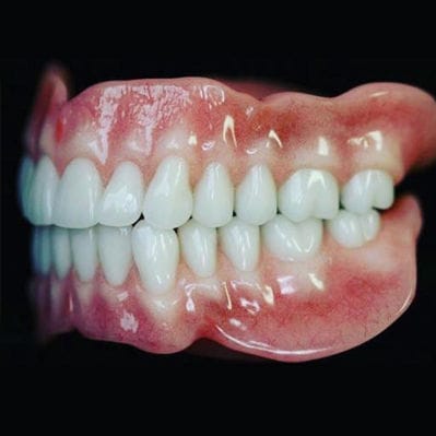 fabricating dentures